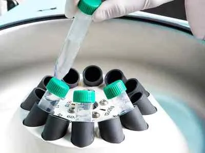 16S / 18S / ITS Metagenomik Analiz